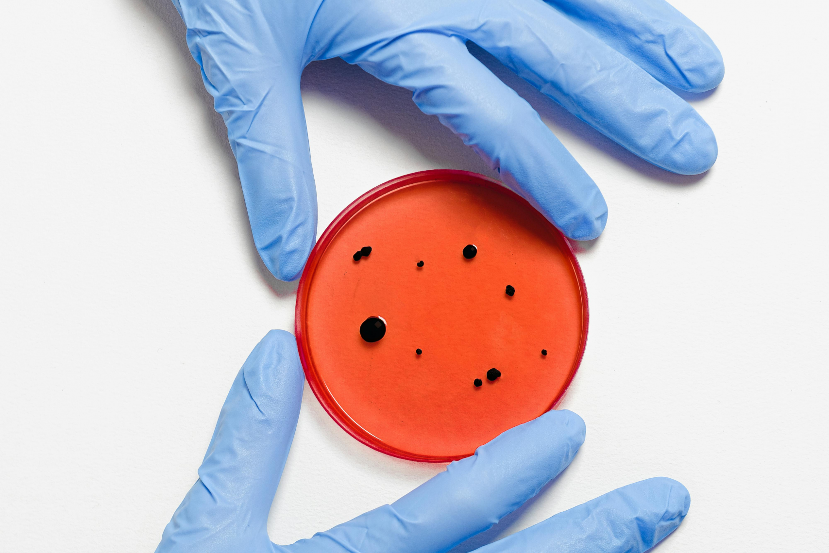 Mehr über den Artikel erfahren OnlineInfo-Veranstaltung zum Start des neuen QS-Verfahrens „Diagnostik und Therapie der Sepsis“ (QS Sepsis) – 11. November 2025